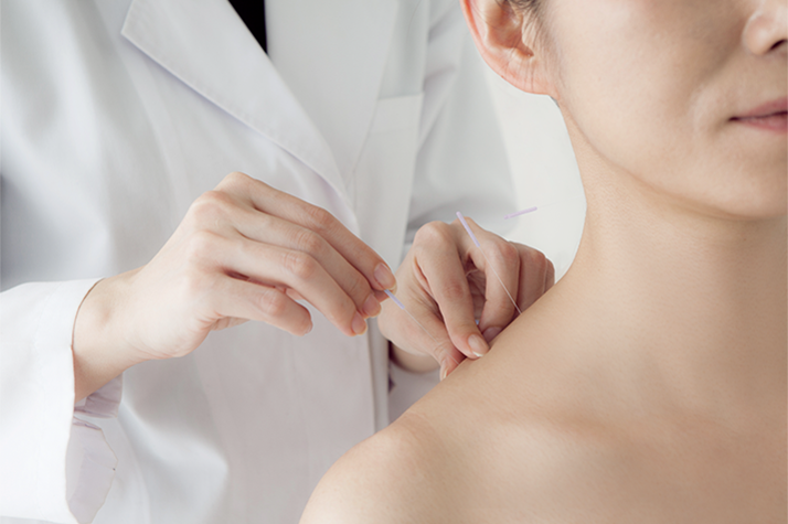 Acupuncture Therapy London